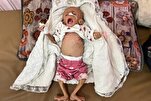 Ein weiteres Baby stirbt in Gaza / 17.000 palästinensische Kinder sind unterernährt