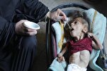Over 66,000 Gaza Kids Suffering from Severe Malnutrition: UNRWA